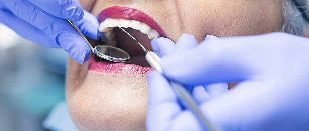 Best Emergency Tooth Extraction in Meridian, PA